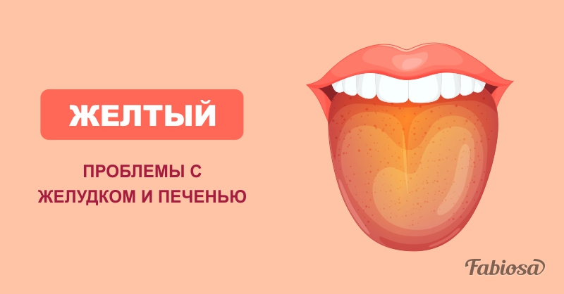 12 проблем со здоровьем, которые можно выявить по цвету вашего языка
