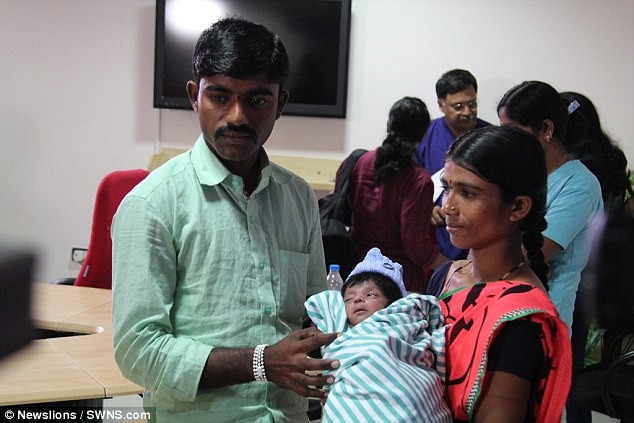  Шок: индийские врачи сделали операцию мальчику, родившемуся с четырьмя ногами!